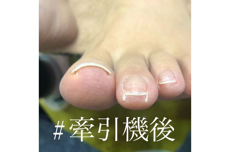 E44C3701-3703-4E33-ABD0-BCF078165E7F