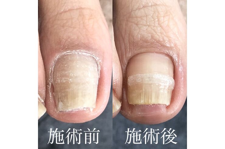 D63E16D2-C525-4CD7-9CC6-1EC80AABE5F8